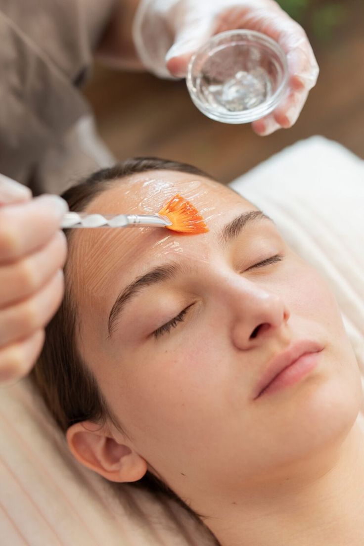 Chemical Peel Chemical Peel