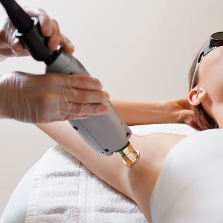 Laser Hair removal