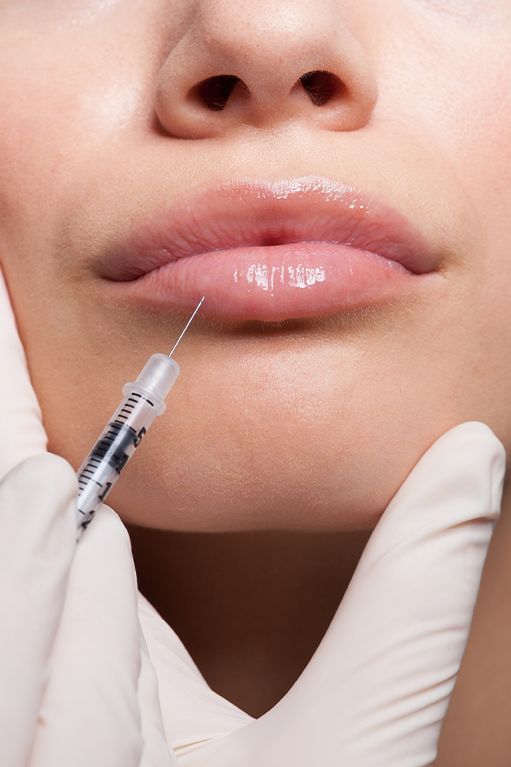 Fillers Fillers